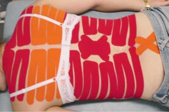 Иллюстрация к книге — Кинезиотейпинг в лечебной практике неврологии и ортопедии [i_250.jpg]