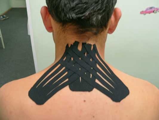 Иллюстрация к книге — Кинезиотейпинг в лечебной практике неврологии и ортопедии [i_256.jpg]