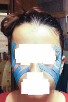 Иллюстрация к книге — Кинезиотейпинг в лечебной практике неврологии и ортопедии [i_259.jpg]