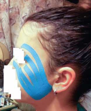 Иллюстрация к книге — Кинезиотейпинг в лечебной практике неврологии и ортопедии [i_260.jpg]