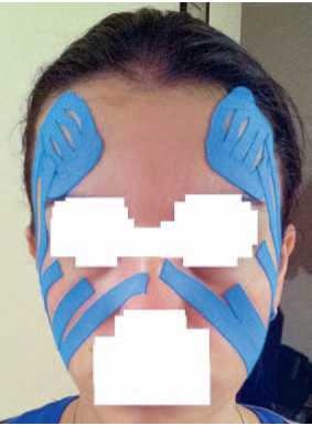 Иллюстрация к книге — Кинезиотейпинг в лечебной практике неврологии и ортопедии [i_261.jpg]