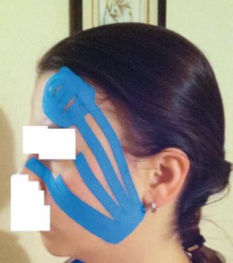 Иллюстрация к книге — Кинезиотейпинг в лечебной практике неврологии и ортопедии [i_262.jpg]