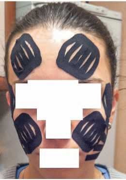 Иллюстрация к книге — Кинезиотейпинг в лечебной практике неврологии и ортопедии [i_263.jpg]