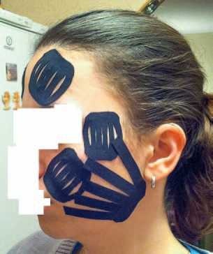 Иллюстрация к книге — Кинезиотейпинг в лечебной практике неврологии и ортопедии [i_264.jpg]