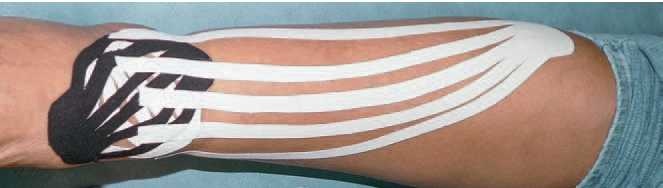 Иллюстрация к книге — Кинезиотейпинг в лечебной практике неврологии и ортопедии [i_266.jpg]