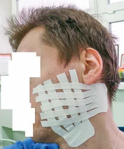 Иллюстрация к книге — Кинезиотейпинг в лечебной практике неврологии и ортопедии [i_267.jpg]