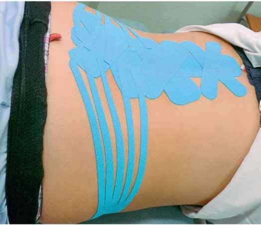 Иллюстрация к книге — Кинезиотейпинг в лечебной практике неврологии и ортопедии [i_268.jpg]