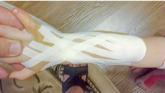 Иллюстрация к книге — Кинезиотейпинг в лечебной практике неврологии и ортопедии [i_269.jpg]