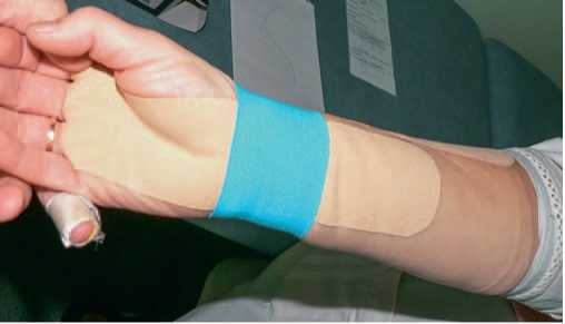 Иллюстрация к книге — Кинезиотейпинг в лечебной практике неврологии и ортопедии [i_271.jpg]