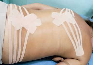 Иллюстрация к книге — Кинезиотейпинг в лечебной практике неврологии и ортопедии [i_274.jpg]