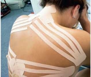 Иллюстрация к книге — Кинезиотейпинг в лечебной практике неврологии и ортопедии [i_275.jpg]