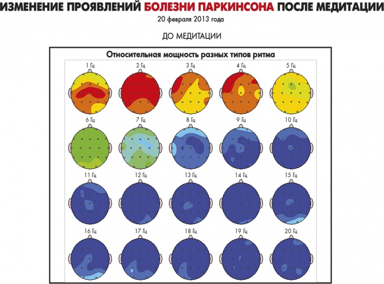Иллюстрация к книге — Сам себе плацебо: как использовать силу подсознания для здоровья и процветания [i_040.jpg]
