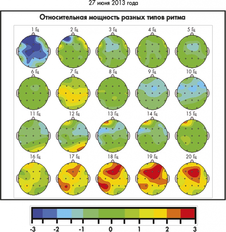 Иллюстрация к книге — Сам себе плацебо: как использовать силу подсознания для здоровья и процветания [i_044.jpg]