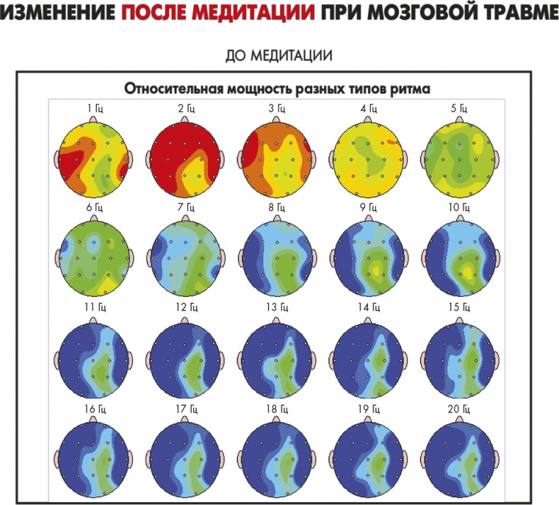 Иллюстрация к книге — Сам себе плацебо: как использовать силу подсознания для здоровья и процветания [i_048.jpg]