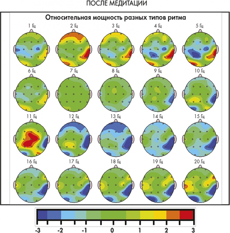 Иллюстрация к книге — Сам себе плацебо: как использовать силу подсознания для здоровья и процветания [i_061.jpg]