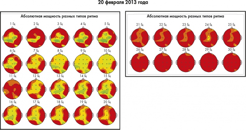 Иллюстрация к книге — Сам себе плацебо: как использовать силу подсознания для здоровья и процветания [i_064.jpg]
