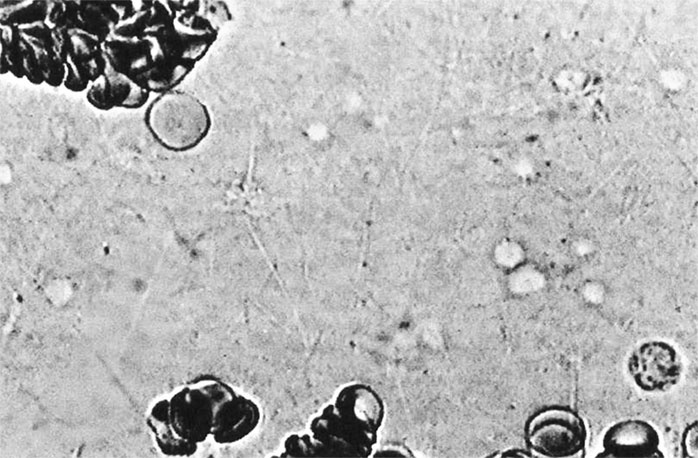 Иллюстрация к книге — Пациент Разумный. Ловушки "врачебной" диагностики, о которых должен знать каждый [i_016.jpg]