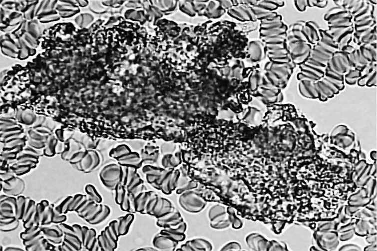 Иллюстрация к книге — Пациент Разумный. Ловушки "врачебной" диагностики, о которых должен знать каждый [i_017.jpg]