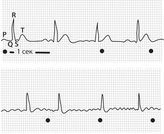 Иллюстрация к книге — Тук-тук, сердце! Как подружиться с самым неутомимым органом и что будет, если этого не сделать [i_014.jpg]