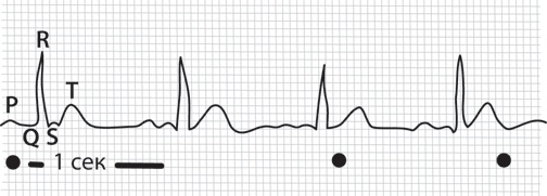 Иллюстрация к книге — Тук-тук, сердце! Как подружиться с самым неутомимым органом и что будет, если этого не сделать [i_016.jpg]