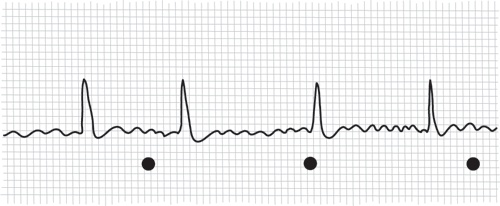 Иллюстрация к книге — Тук-тук, сердце! Как подружиться с самым неутомимым органом и что будет, если этого не сделать [i_019.jpg]