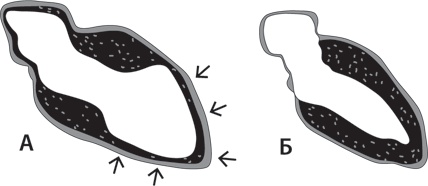 Иллюстрация к книге — Тук-тук, сердце! Как подружиться с самым неутомимым органом и что будет, если этого не сделать [i_028.jpg]