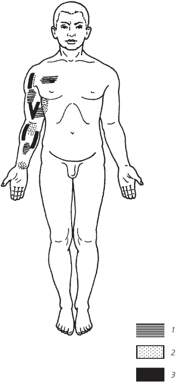 Иллюстрация к книге — Лечебные точки организма. Снимаем боли в суставах и мышцах, укрепляем кожу, вены, сон и иммунитет [_74.jpg]