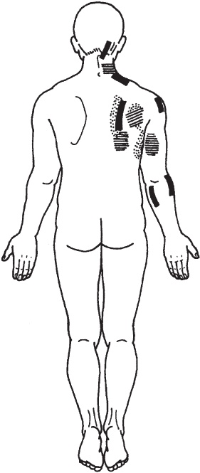 Иллюстрация к книге — Лечебные точки организма. Снимаем боли в суставах и мышцах, укрепляем кожу, вены, сон и иммунитет [_75.jpg]