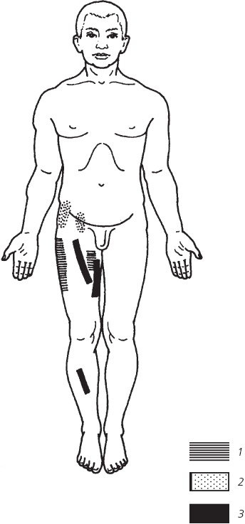 Иллюстрация к книге — Лечебные точки организма. Снимаем боли в суставах и мышцах, укрепляем кожу, вены, сон и иммунитет [_78.jpg]