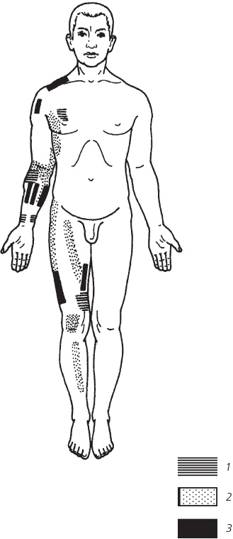 Иллюстрация к книге — Лечебные точки организма. Снимаем боли в суставах и мышцах, укрепляем кожу, вены, сон и иммунитет [_85.jpg]