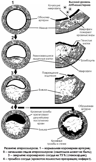 Иллюстрация к книге — Заболевания сердца и сосудов. Профилактика и лечение [i_003.jpg]