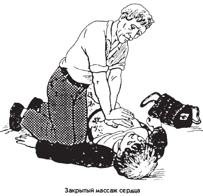 Иллюстрация к книге — Заболевания сердца и сосудов. Профилактика и лечение [i_024.jpg]