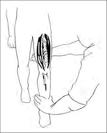 Иллюстрация к книге — Двигательная активность и здоровье. От лечебной гимнастики до паркура [i_008.jpg]