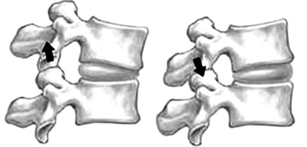 Иллюстрация к книге — Здоровый позвоночник [i_004.jpg]