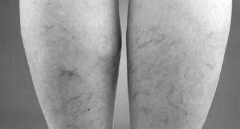 Иллюстрация к книге — Девочка. Девушка. Женщина [i_306.jpg]