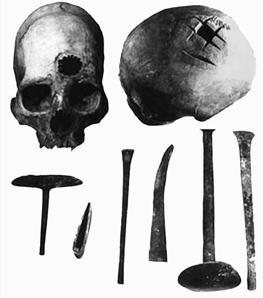 Иллюстрация к книге — 100 великих тайн медицины [i_004.jpg]