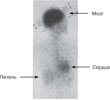 Иллюстрация к книге — Удивительные истории о мозге, или рекорды памяти коноплянки [i_030.jpg]