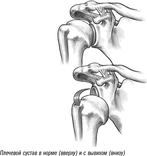 Иллюстрация к книге — Первая помощь своими руками. Если скорая не спешит [i_025.jpg]