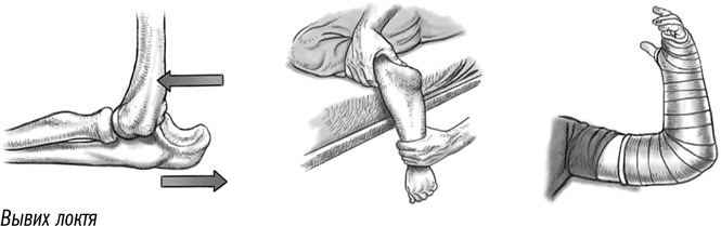 Иллюстрация к книге — Первая помощь своими руками. Если скорая не спешит [i_031.jpg]