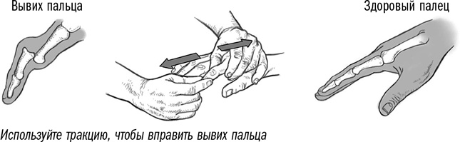 Иллюстрация к книге — Первая помощь своими руками. Если скорая не спешит [i_032.jpg]