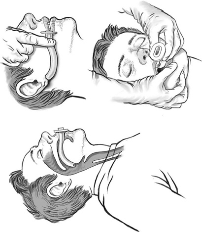 Иллюстрация к книге — Первая помощь своими руками. Если скорая не спешит [i_066.jpg]