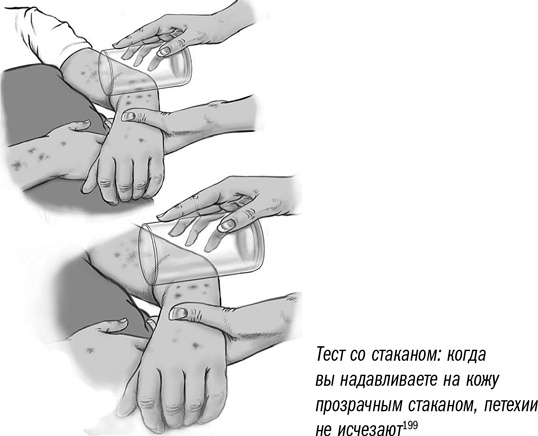 Иллюстрация к книге — Первая помощь своими руками. Если скорая не спешит [i_091.jpg]