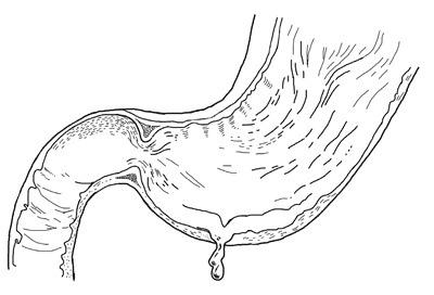 Иллюстрация к книге — Никто, кроме вас. Рассказы, которые могут спасти жизнь [i_015.jpg]
