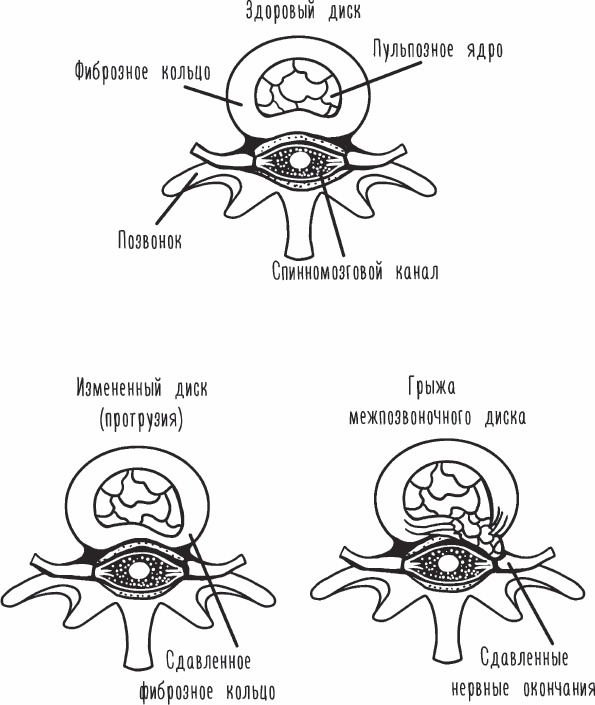 Иллюстрация к книге — Благодарный позвоночник. Как навсегда избавить его от боли. Домашняя кинезиология [_01.jpg]