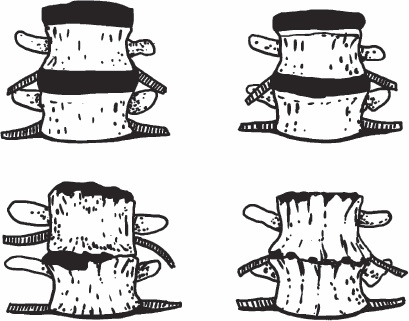 Иллюстрация к книге — Благодарный позвоночник. Как навсегда избавить его от боли. Домашняя кинезиология [_06.jpg]