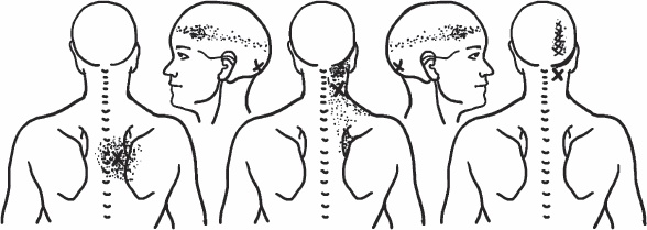 Иллюстрация к книге — Благодарный позвоночник. Как навсегда избавить его от боли. Домашняя кинезиология [_08.jpg]