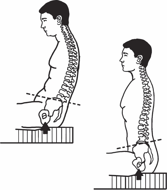 Иллюстрация к книге — Благодарный позвоночник. Как навсегда избавить его от боли. Домашняя кинезиология [_61.jpg]