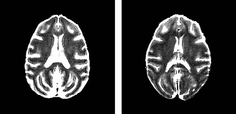 Иллюстрация к книге — Фрукторианство. Новый взгляд на эволюцию питания человека [_252.jpg]