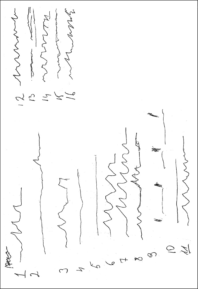 Иллюстрация к книге — Особенности дифференциальной диагностики расстройств мышления на примерах клинической практики [i_014.jpg]