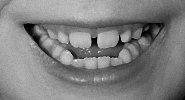 Иллюстрация к книге — Читай лица! Специальная методика чтения лиц и эмоций [i_151.jpg]